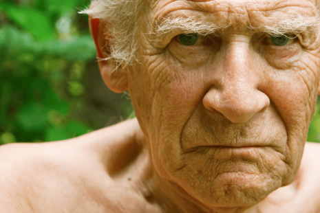 when alzheimer's patients hit